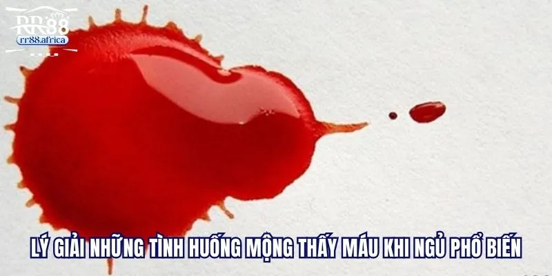 Lý giải những tình huống mộng thấy máu khi ngủ phổ biến